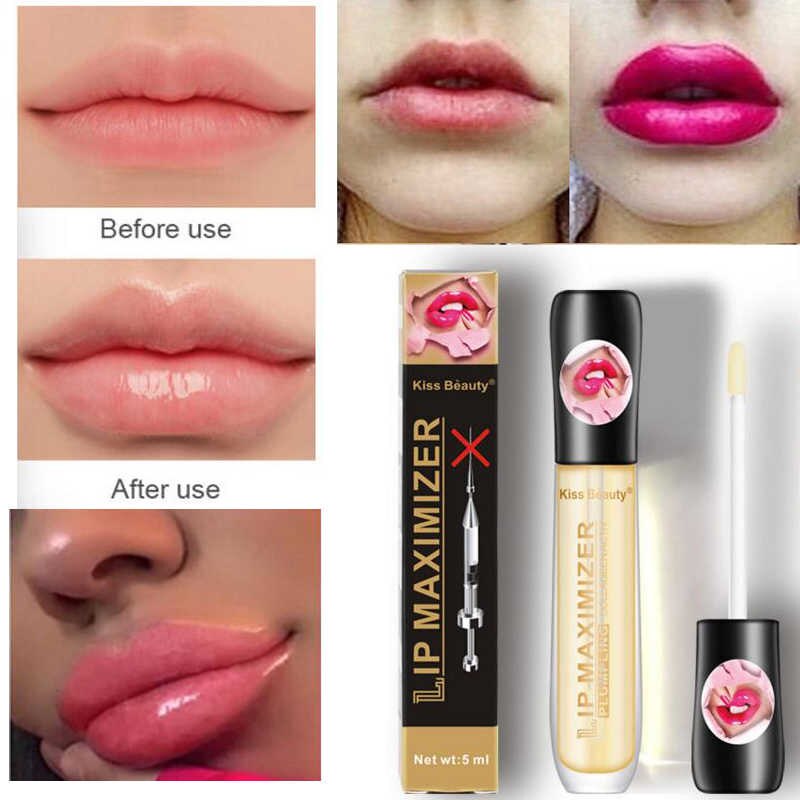Voluminizador Labios