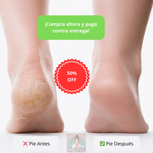 Removedor de Callos Eléctrico